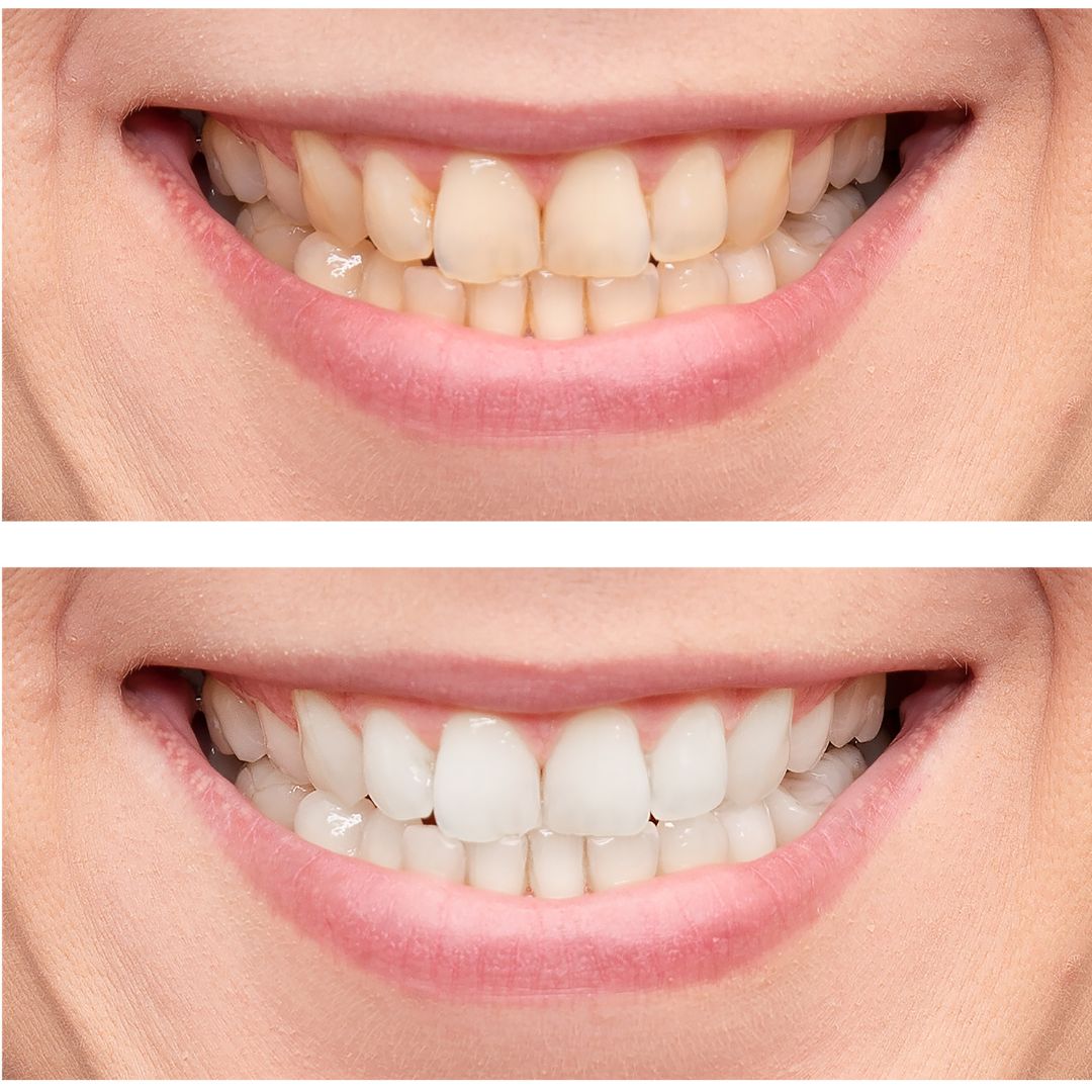 Cosmetic Dentistry