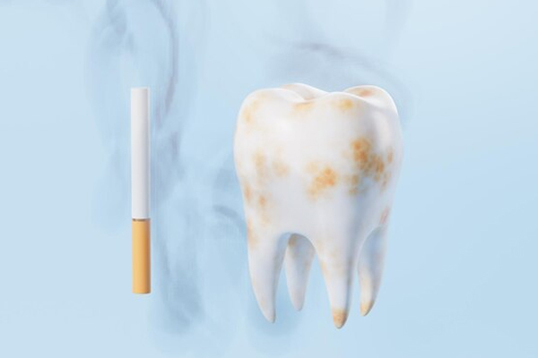 IS SMOKING A SILENT KILLER FOR YOUR TEETH AND GUMS