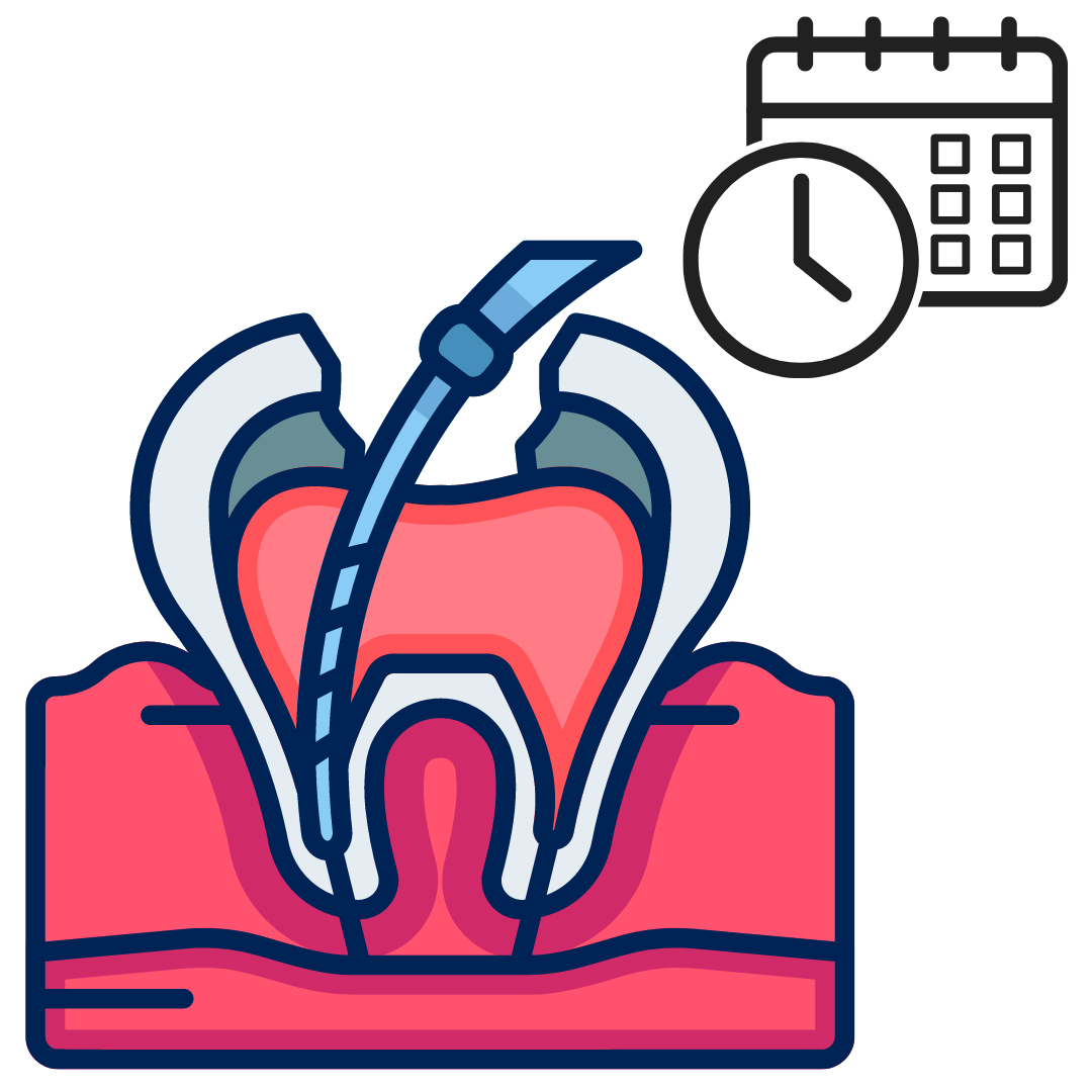 Worried About The Number Of Appointments For A Root Canal Treatment